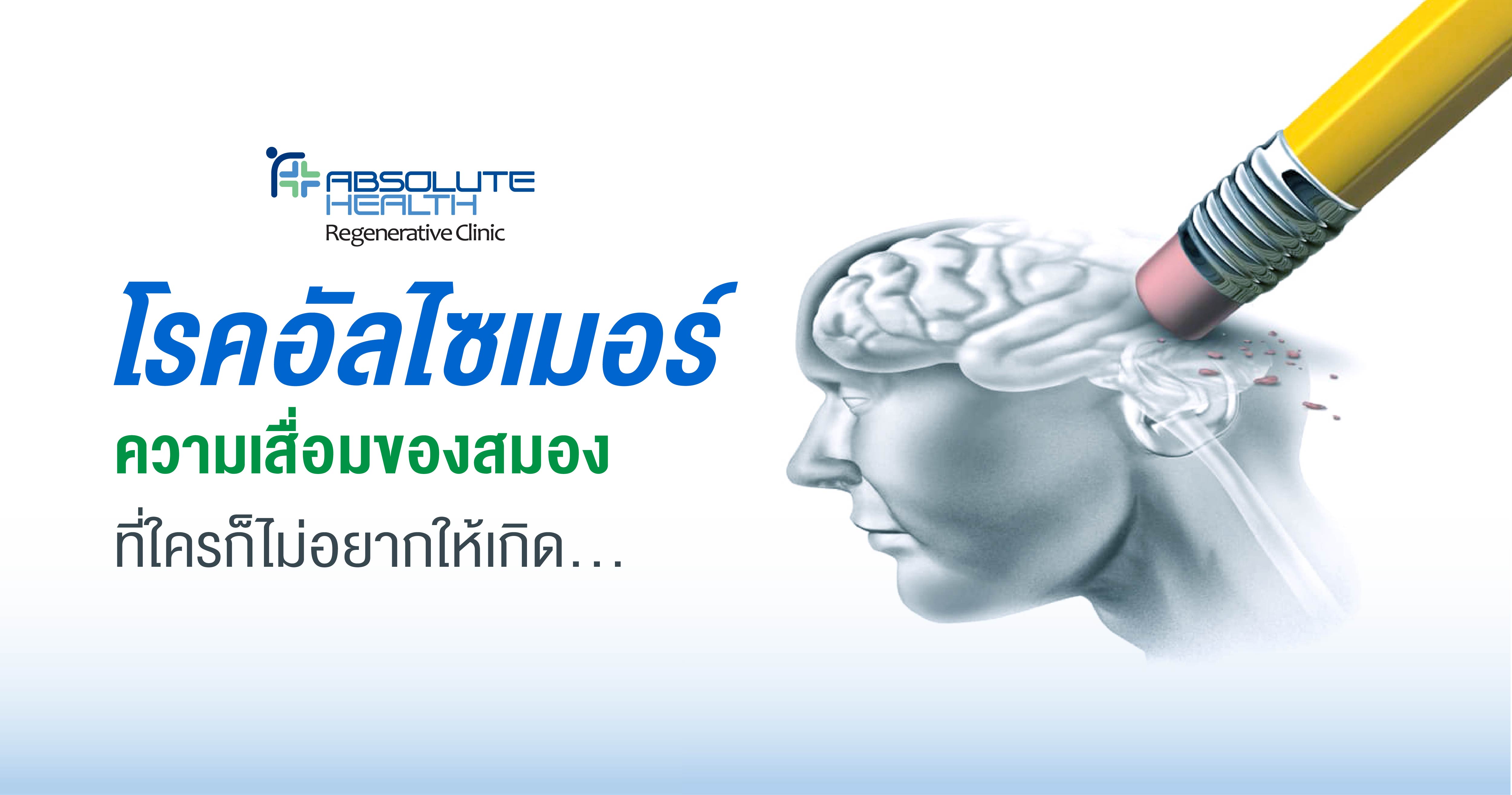 อัลไซเมอร์