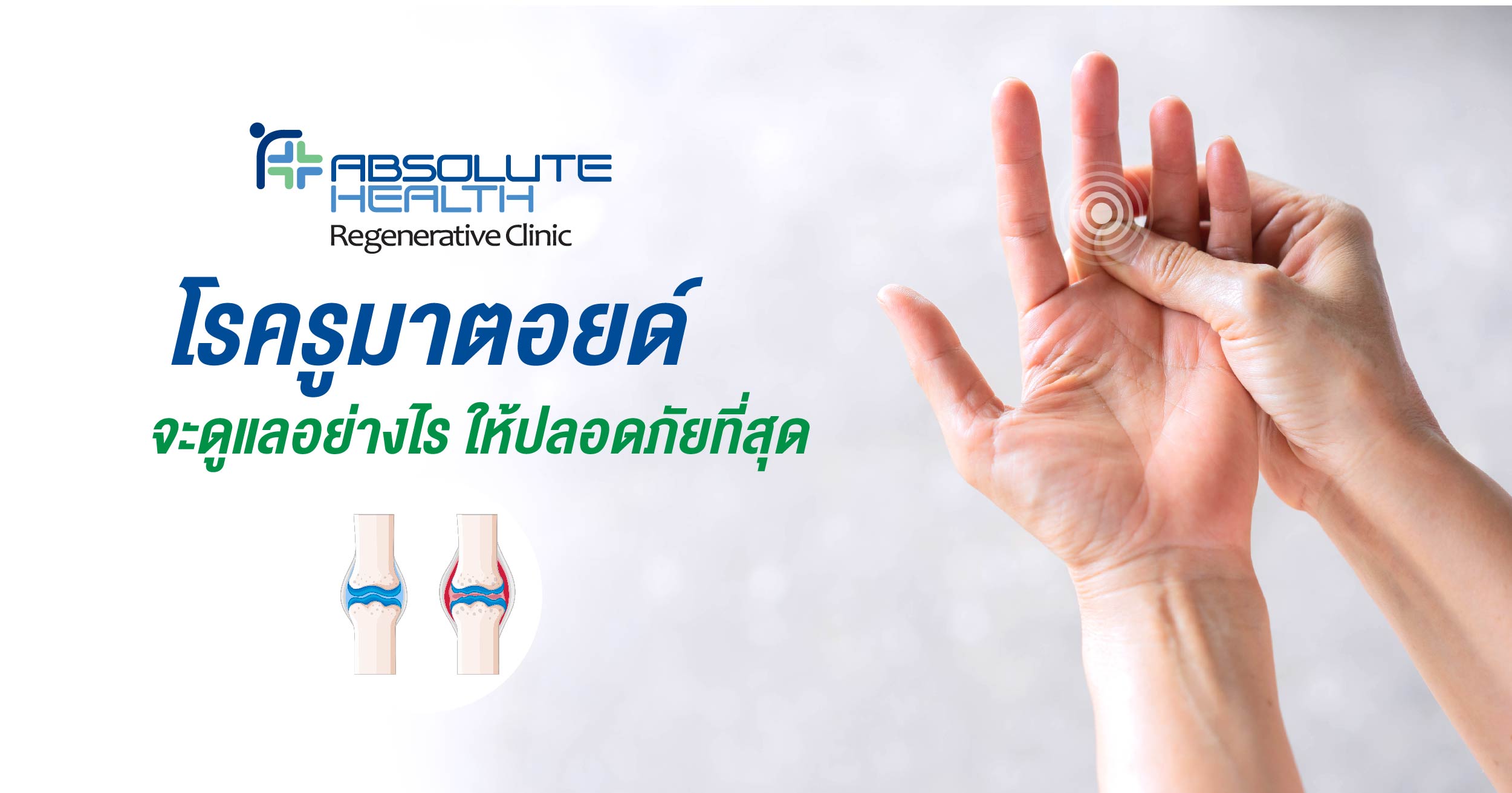 โรครูมาตอยด์  จะดูแลอย่างไร ให้ปลอดภัยที่สุด