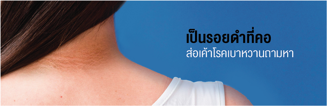 เป็นรอยดำที่คอ ส่อเค้าโรคเบาหวานถามหา